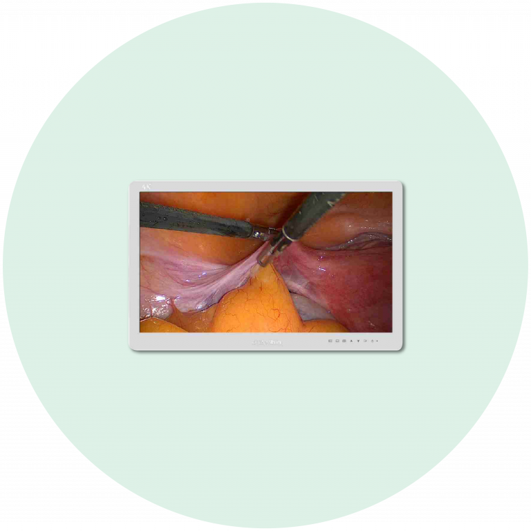 monitor chirurgici