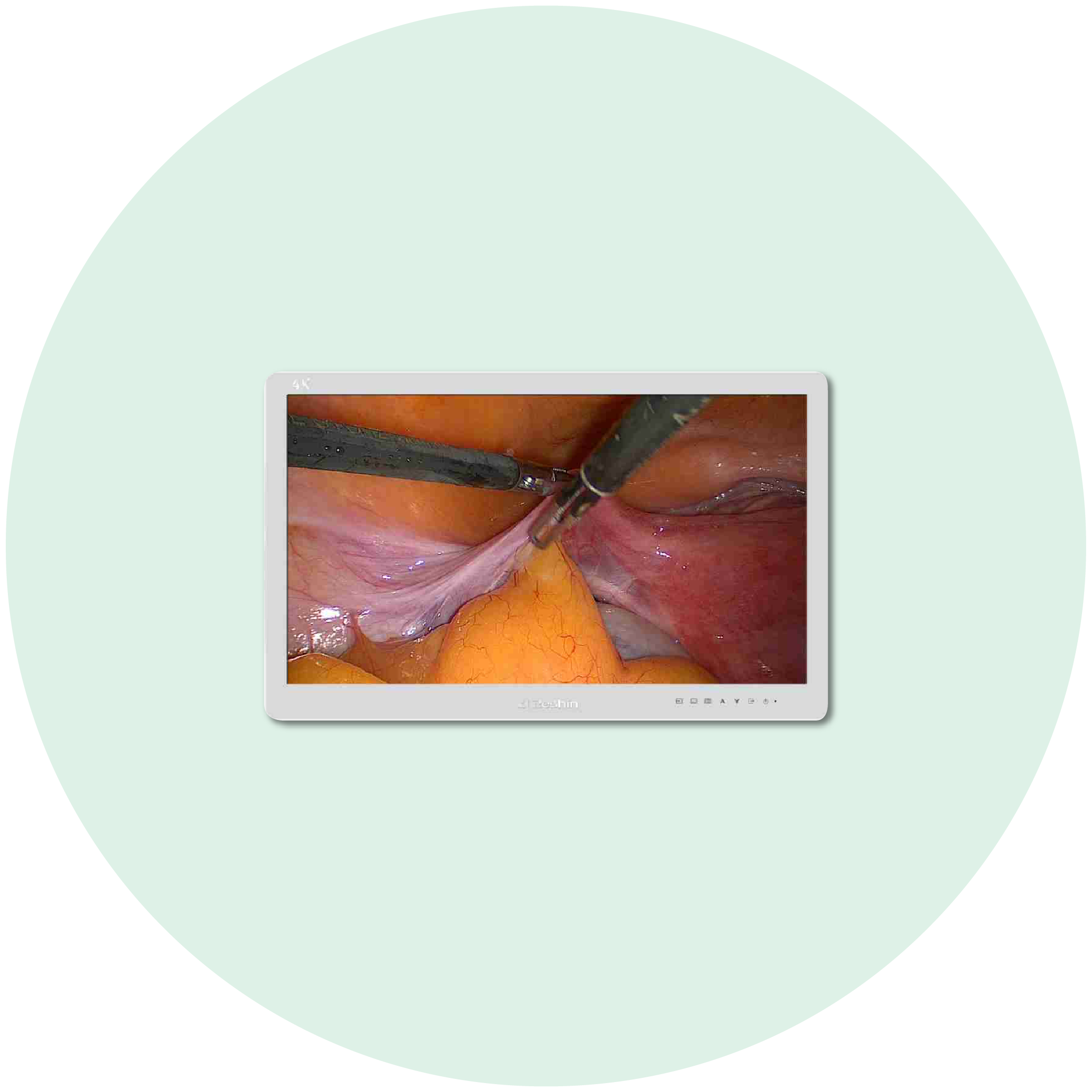monitor chirurgici