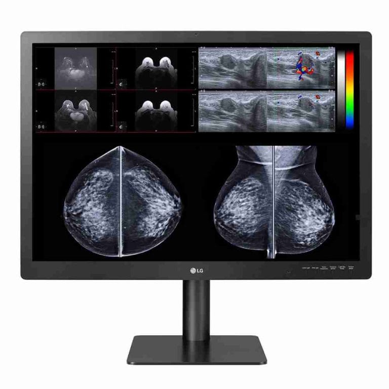 Monitor mammografico LG